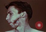 Image of wounded soldier European Theater, 1945, second 14 stock footage video 65675077546
