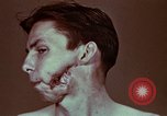 Image of wounded soldier European Theater, 1945, second 15 stock footage video 65675077546
