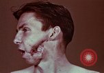 Image of wounded soldier European Theater, 1945, second 16 stock footage video 65675077546