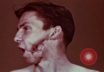Image of wounded soldier European Theater, 1945, second 17 stock footage video 65675077546