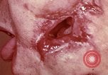 Image of wounded soldier European Theater, 1945, second 22 stock footage video 65675077546