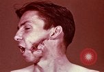 Image of wounded soldier European Theater, 1945, second 23 stock footage video 65675077546