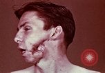 Image of wounded soldier European Theater, 1945, second 24 stock footage video 65675077546