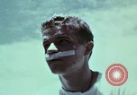 Image of wounded soldier European Theater, 1945, second 33 stock footage video 65675077546