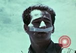 Image of wounded soldier European Theater, 1945, second 35 stock footage video 65675077546