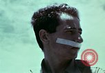 Image of wounded soldier European Theater, 1945, second 36 stock footage video 65675077546