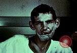 Image of wounded soldier European Theater, 1945, second 40 stock footage video 65675077546