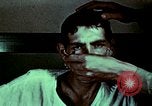 Image of wounded soldier European Theater, 1945, second 41 stock footage video 65675077546