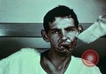 Image of wounded soldier European Theater, 1945, second 48 stock footage video 65675077546