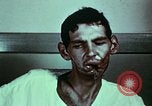 Image of wounded soldier European Theater, 1945, second 49 stock footage video 65675077546