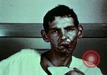 Image of wounded soldier European Theater, 1945, second 50 stock footage video 65675077546