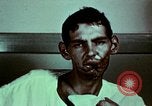 Image of wounded soldier European Theater, 1945, second 51 stock footage video 65675077546