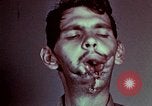 Image of wounded soldier European Theater, 1945, second 57 stock footage video 65675077546