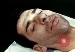 Image of eye surgery United States USA, 1945, second 36 stock footage video 65675077558