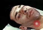 Image of eye surgery United States USA, 1945, second 38 stock footage video 65675077558