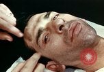 Image of eye surgery United States USA, 1945, second 39 stock footage video 65675077558