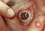 Image of eye surgery United States USA, 1945, second 42 stock footage video 65675077558
