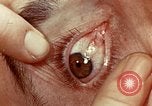 Image of eye surgery United States USA, 1945, second 47 stock footage video 65675077558