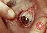 Image of eye surgery United States USA, 1945, second 48 stock footage video 65675077558