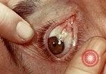 Image of eye surgery United States USA, 1945, second 49 stock footage video 65675077558