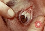 Image of eye surgery United States USA, 1945, second 51 stock footage video 65675077558