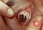 Image of eye surgery United States USA, 1945, second 53 stock footage video 65675077558