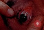Image of eye surgery United States USA, 1945, second 56 stock footage video 65675077558
