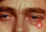 Image of eye surgery United States USA, 1945, second 8 stock footage video 65675077559