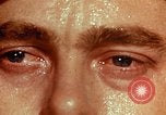 Image of eye surgery United States USA, 1945, second 9 stock footage video 65675077559