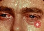 Image of eye surgery United States USA, 1945, second 10 stock footage video 65675077559