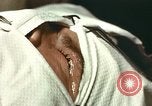 Image of eye surgery United States USA, 1945, second 25 stock footage video 65675077559