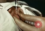 Image of eye surgery United States USA, 1945, second 28 stock footage video 65675077559