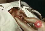 Image of eye surgery United States USA, 1945, second 30 stock footage video 65675077559