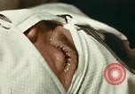 Image of eye surgery United States USA, 1945, second 31 stock footage video 65675077559