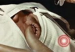 Image of eye surgery United States USA, 1945, second 33 stock footage video 65675077559