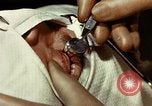 Image of eye surgery United States USA, 1945, second 34 stock footage video 65675077559