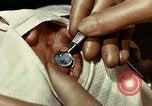 Image of eye surgery United States USA, 1945, second 35 stock footage video 65675077559
