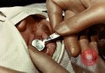 Image of eye surgery United States USA, 1945, second 36 stock footage video 65675077559