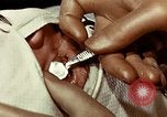 Image of eye surgery United States USA, 1945, second 37 stock footage video 65675077559