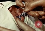 Image of eye surgery United States USA, 1945, second 38 stock footage video 65675077559