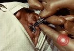 Image of eye surgery United States USA, 1945, second 39 stock footage video 65675077559