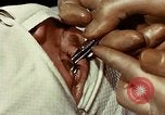 Image of eye surgery United States USA, 1945, second 40 stock footage video 65675077559