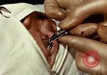 Image of eye surgery United States USA, 1945, second 42 stock footage video 65675077559