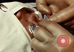 Image of eye surgery United States USA, 1945, second 43 stock footage video 65675077559