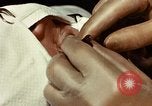 Image of eye surgery United States USA, 1945, second 44 stock footage video 65675077559