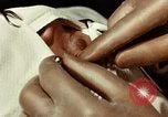 Image of eye surgery United States USA, 1945, second 45 stock footage video 65675077559