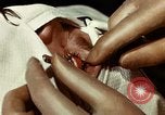 Image of eye surgery United States USA, 1945, second 46 stock footage video 65675077559