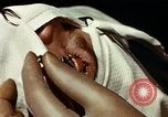 Image of eye surgery United States USA, 1945, second 47 stock footage video 65675077559