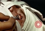 Image of eye surgery United States USA, 1945, second 48 stock footage video 65675077559
