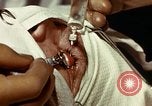 Image of eye surgery United States USA, 1945, second 50 stock footage video 65675077559